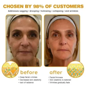 Botox Bee Venom Wrinkle Removal Cream - Image 6