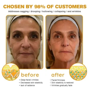 Botox Bee Venom Wrinkle Removal Cream-Last Day Promotion 80% OFF - Image 7
