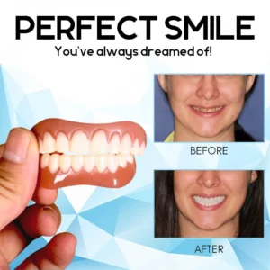 Silicone Reline Denture Set - Image 4