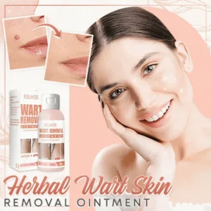 Herbal Wart Skin Removal Ointment - Image 2