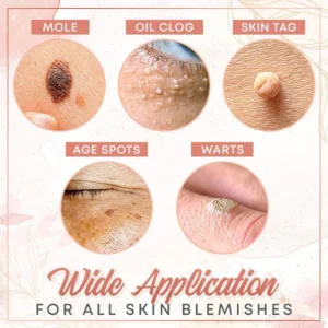 Herbal Wart Skin Removal Ointment - Image 8