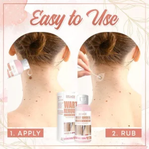 Herbal Wart Skin Removal Ointment - Image 10