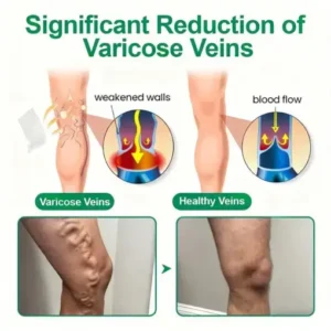 VeinTarget Microneedle Patch Once Daily, Visible Results in 7 Days - Image 3