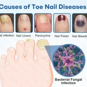 Nano Rapid Clear Nail Fungus Rapair Liquid Effective in Seven Days, Permanently Eliminates the Root - Image 5