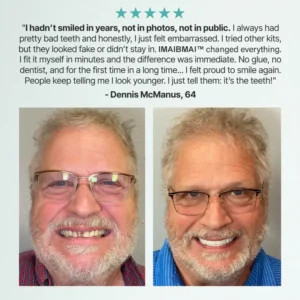 Medical Full Denture with Strong Suctiond - Image 13