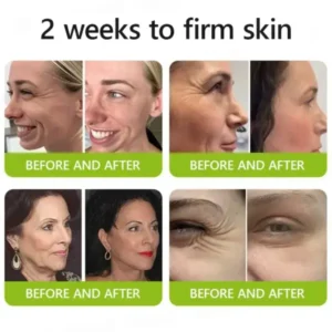 Botox & Retinol Shot - Image 5