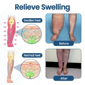 Roll-On Cream for Lymphatic Drainage & Swelling Relief - Image 3