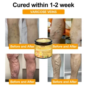 LOVILDS Bee Venom Advanced Joint and Bone Healing Cream - Image 7