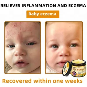Bee Venom Skin Restoration Cream - Image 6