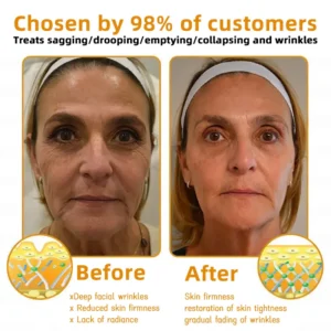 Bee Venom Skin Restoration Cream - Image 10