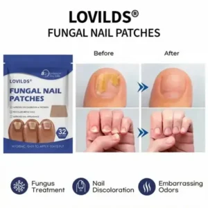 FUNGAL NAIL PATCHES - Image 3