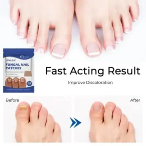 FUNGAL NAIL PATCHES - Image 4