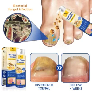PsoriaHeal psoriasis Spray pro - Image 7