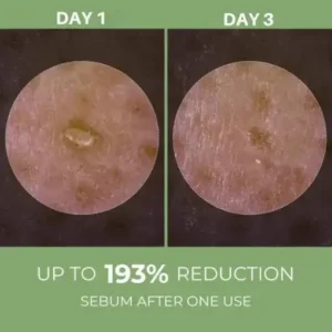Rice Peel Ampoule - Image 2