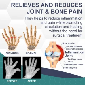 Bee Venom Pain and Bone Healing Cream - Image 2