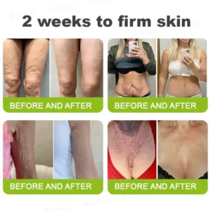 Botox & Retinol Shot - Image 4