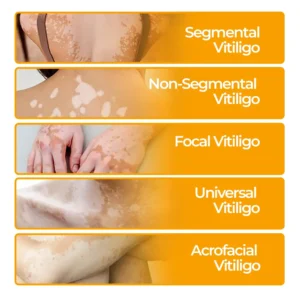 Evenora Herbal Spray PRO - Image 6
