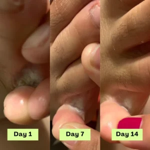 55% off AntiFungal Relief Soap Bar - Image 7