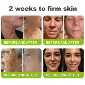 🇺🇸 Made and shipped from the USA Botox & Vita-A Retinol Shot Wrinkle-Lift Tightening cream - Image 7