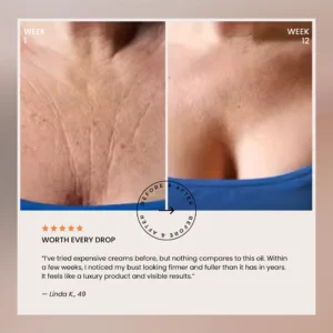 Bust Lift Oil - Image 10