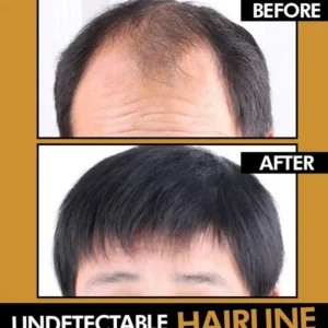 Men's Hair Topper - Image 2