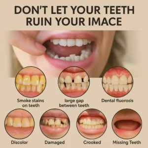 BioFusion Dentures - Image 2