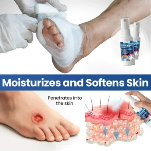 Liquid Wound Film Spray - Image 9