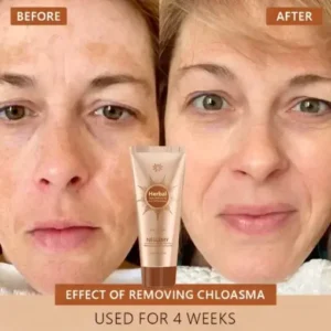 Whitening and Spot-Removing Face Mask Suitable for face and body - Image 2