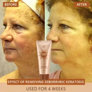 Whitening and Spot-Removing Face Mask Suitable for face and body - Image 3