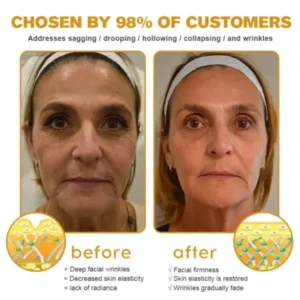New Year Sale Botox Bee Venom Wrinkle Removal Cream - Image 5