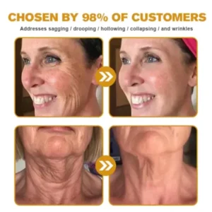 New Year Sale Botox Bee Venom Wrinkle Removal Cream - Image 6