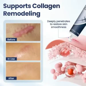 DERMALUX Texture Repair Gel - Image 6