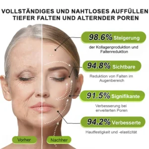 Now regain youthful skin. 💫👨‍⚕️ NESLEMY ™ Wrinkle relaxer & Vita-A Retinol Shot Wrinkle Lift Firming Cream - Image 16