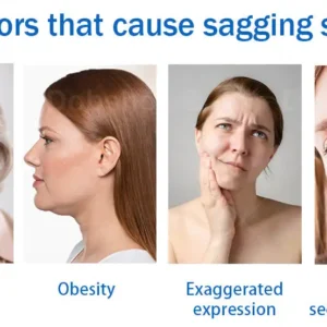 Sleeping V-Face Beauty Device - Image 2