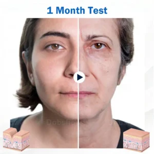 Sleeping V-Face Beauty Device - Image 4