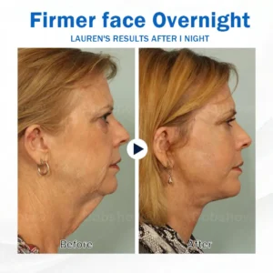 Sleeping V-Face Beauty Device - Image 8