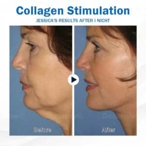 Sleeping V-Face Beauty Device - Image 9