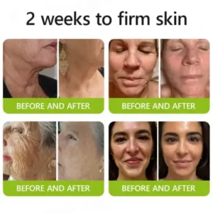Botox Retinol Shot , FDA-Compliant Formula to Firm Sagging Skin Reduce Puffy Eyes - Image 4