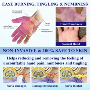 NumbAway CoolEase Neuropathy Spray - Image 5
