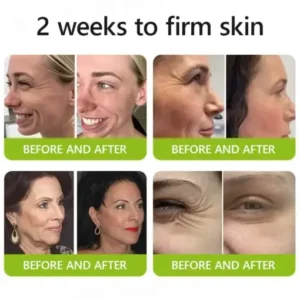 Peptide-Infused Firming Shot Dermatologist-Approved Formula for Powerful Lifting Visibly De-puffing - Image 4
