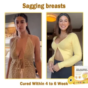 𝑹𝒐𝒚𝒂𝒍 𝑱𝒆𝒍𝒍𝒚 𝑩𝒓𝒆𝒂𝒔𝒕 𝑬𝒏𝒉𝒂𝒏𝒄𝒆𝒎𝒆𝒏𝒕 𝑷𝒂𝒕𝒄𝒉 - Image 3