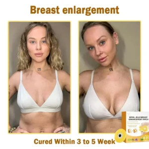 𝑹𝒐𝒚𝒂𝒍 𝑱𝒆𝒍𝒍𝒚 𝑩𝒓𝒆𝒂𝒔𝒕 𝑬𝒏𝒉𝒂𝒏𝒄𝒆𝒎𝒆𝒏𝒕 𝑷𝒂𝒕𝒄𝒉 - Image 4
