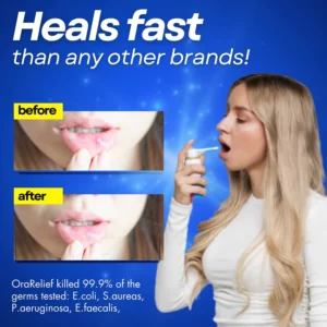 Mouth Ulcer Spray - Image 5