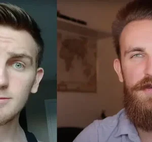 Beard Growth Oil - Image 5