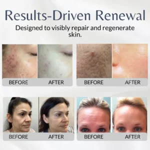 Cellular Renewal System. - Image 2