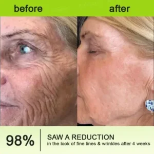 Botulinum Vita-A Retinol Shot Wrinkle-Lift Tightening cream - Image 6