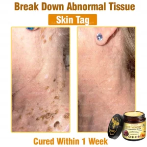 Bee Venom Comprehensive Cream - Image 5