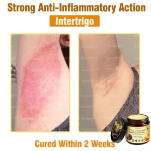 Bee Venom Comprehensive Cream - Image 8