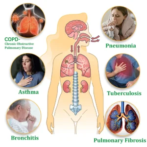 Herbal Lung Cleansing Inhaler - Image 3
