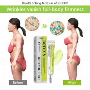 BOTOX & VITA A RETINOL SHOT Wrinkle Lift Tightening Cream - Image 45